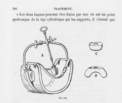 HYSTÉRIE