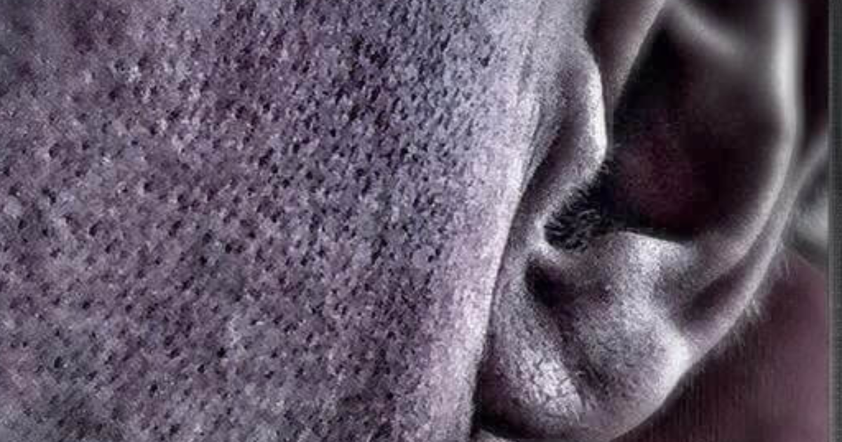 Trois hommes et acouphènes