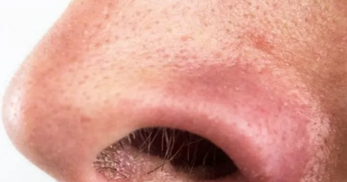 Chap 1 : La Naissance