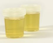 Urine