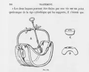 HYSTÉRIE