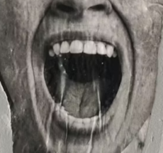 prev