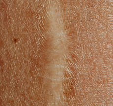 prev