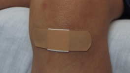 Réouvrir les plaies