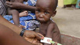 Jour numéro 28 : Squelettique