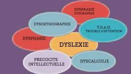 Retard mental : définition, causes et traitement