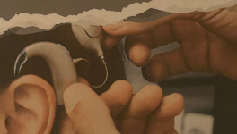 3) L’opération chirurgicale côté gauche.