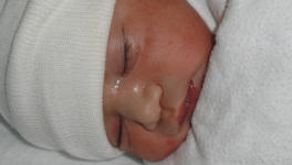 La pyramide des âges...