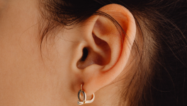 Lobe