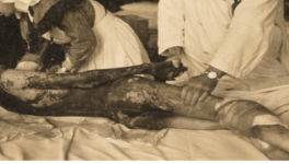 Légende et notes bas de pages ACDM