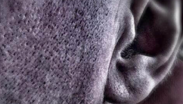 Trois hommes et acouphènes