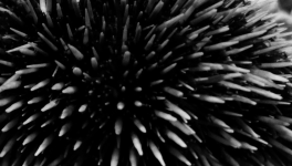 Épisode 4 : Là où ça pique