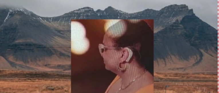 Les garanties et assurances cochlear