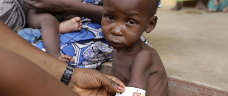 Jour numéro 28 : Squelettique