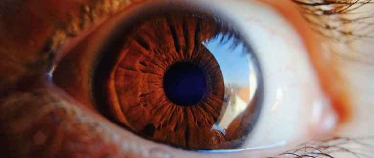 Iris
