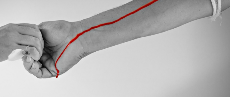 Transfusion