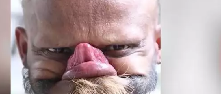 Grimace