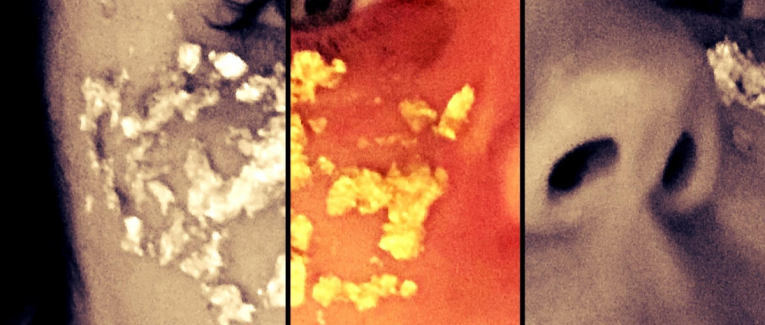 Fracture et lumière