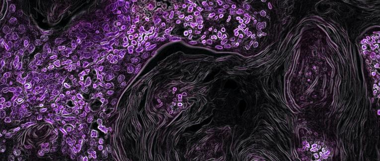 My pandemic story #1