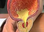 Les bienfaits de la masturbation contre le cancer de prostate