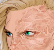 prev