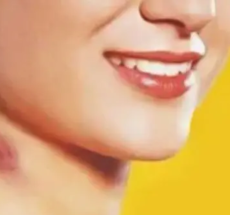 prev