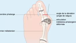 27 - Oignon (challenge #Linktober2025)