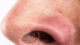 Chap 4 L'abbé Rémy