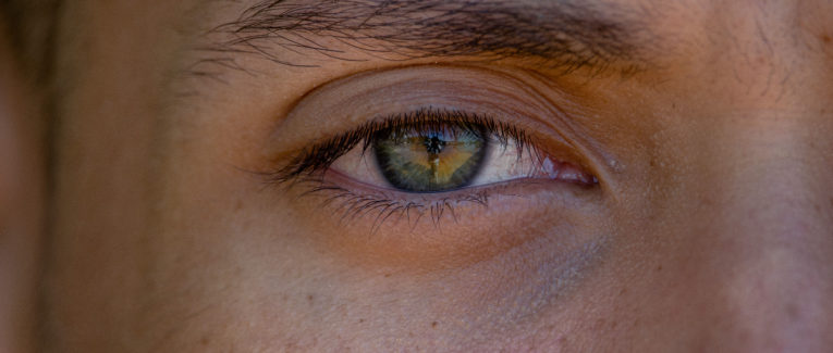 Oeil de verre