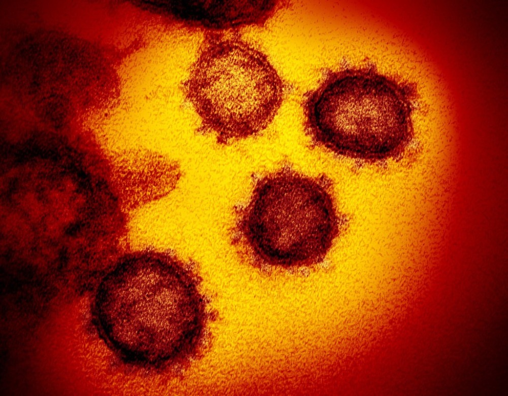 Voici la photo de l'ennemi public n°1 de l'humanité en mars 2020 le virus du Covid-19, appelé Sars-CoV-2.